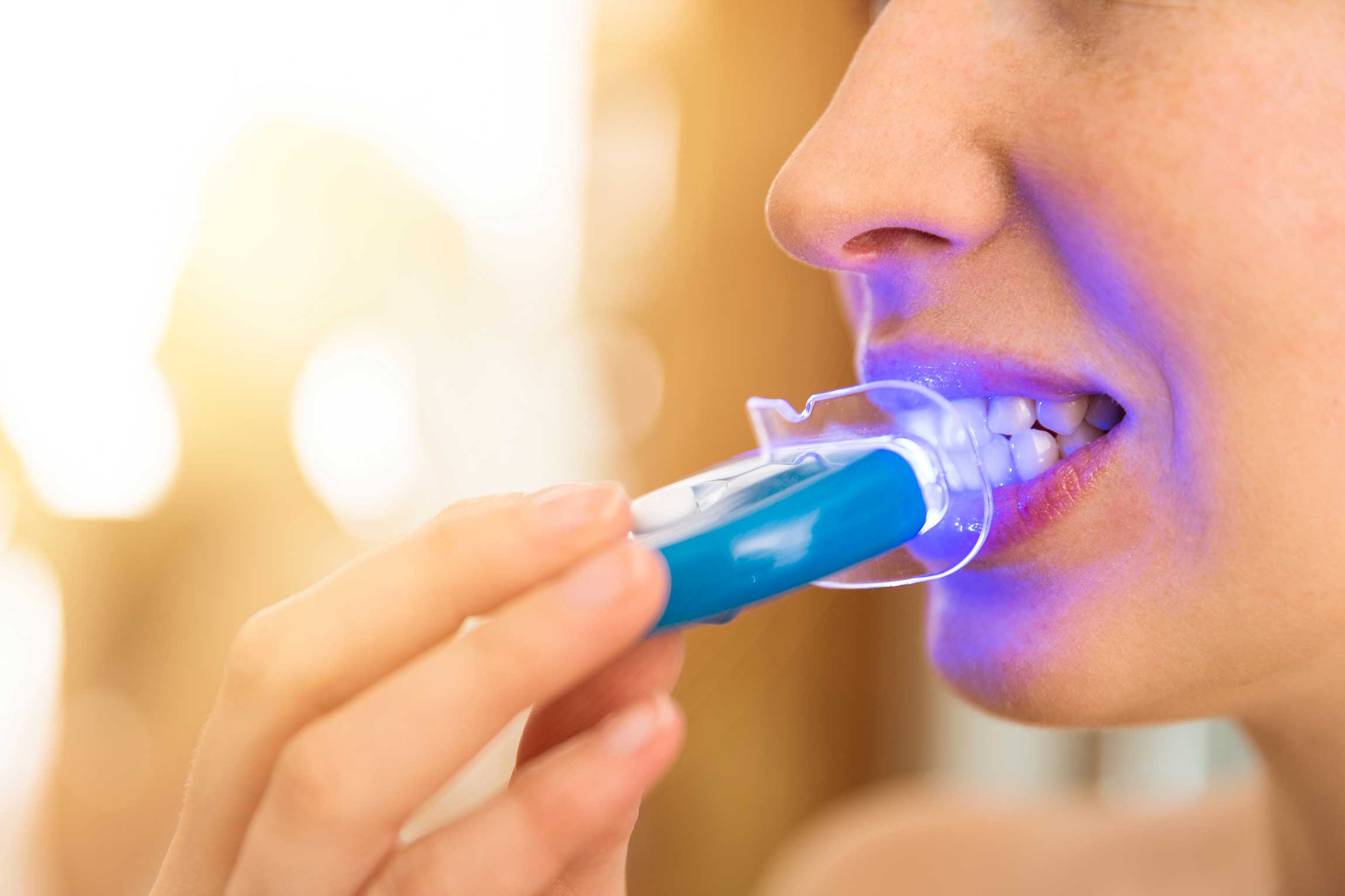 At home Whitening at home.